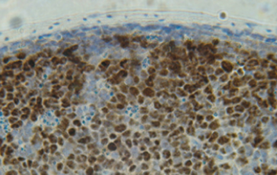 Genetics of B Cells and Lymphomas