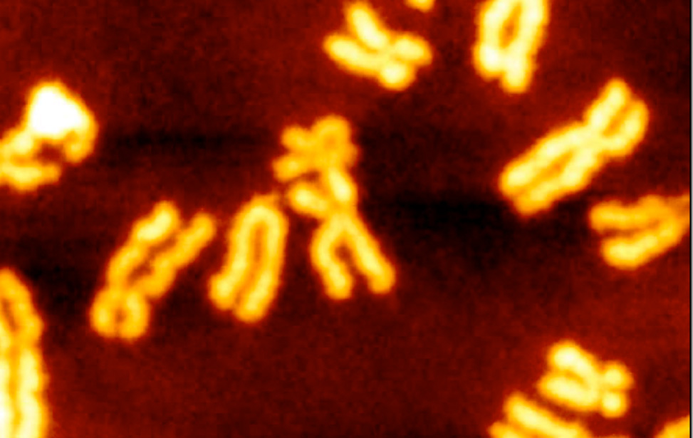 DNA metabolism