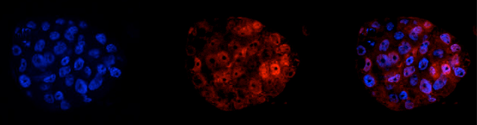 Transcriptional Regulation in Development and Cancer