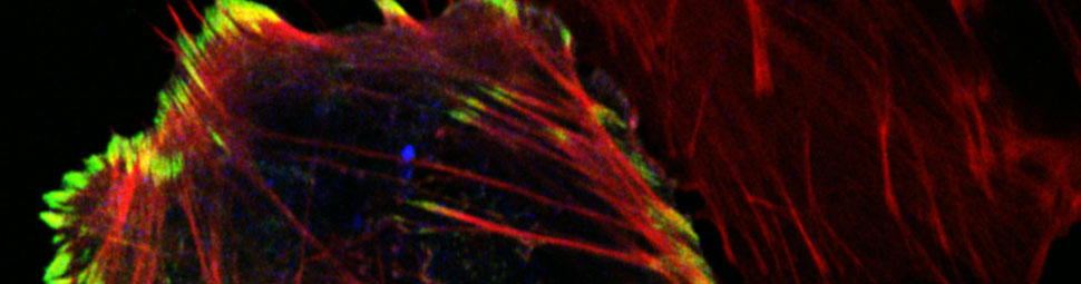 Mechanisms of Tumor Cell Migrationr