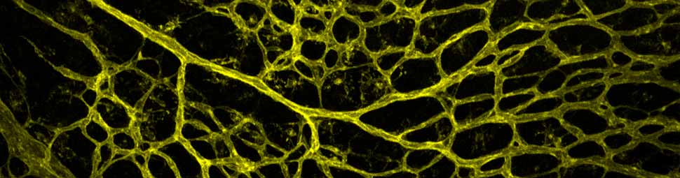 Retinal blood vessels