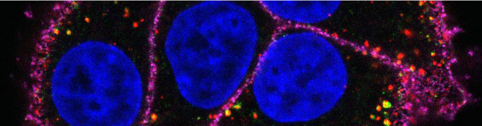 Ubiquitin and Signal Transduction