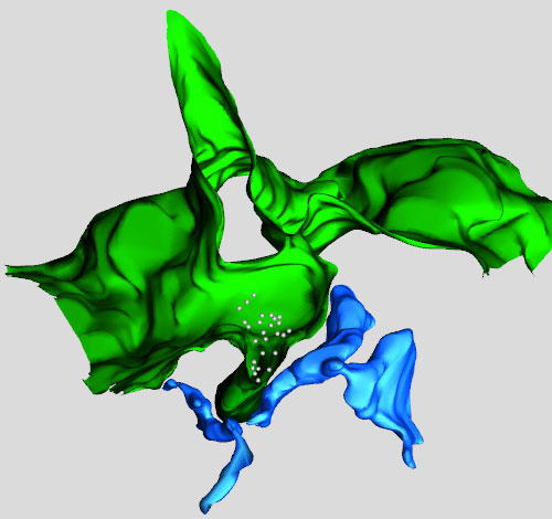 Ricostruzione 3D medianteTomografia Elettronica (ET) di una zona della superficie cellulare (in verde) che si ripiega verso l'interno della cellula intrappolando i recettori (i pallini bianchi). Il reticolo endoplasmatico (in blu) ha preso contatto con la superficie cellulare introflessa e la 'tira', facendola  staccare e trascinandola all'interno della cellula. I recettori vengo in questo modo rimossi dalla superficie cellulare.