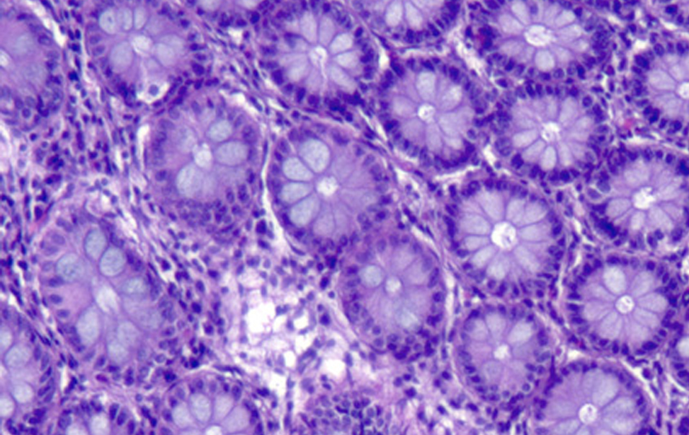 Histopathology