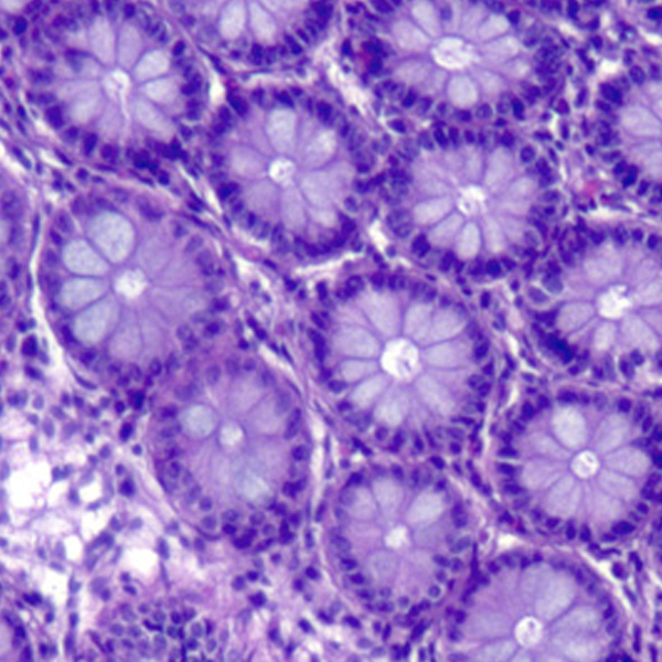Histopathology