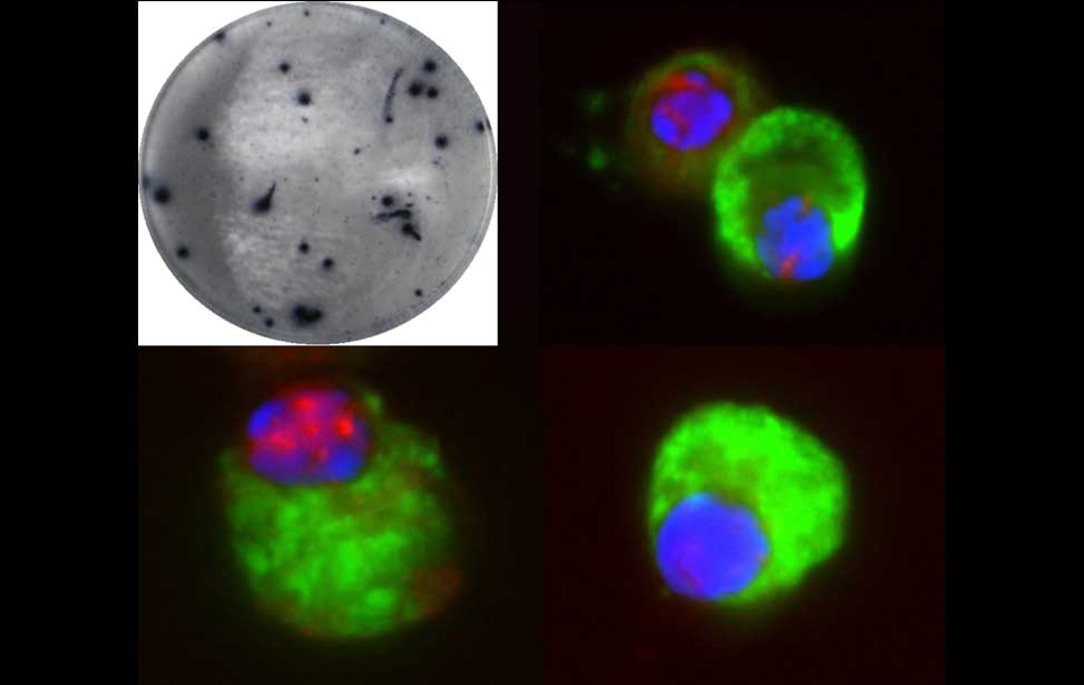 Antibody producing cells