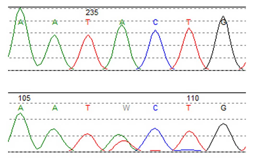 Genetics of Diffuse Large B-cell lymphomas